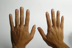 Imposição de Mãos